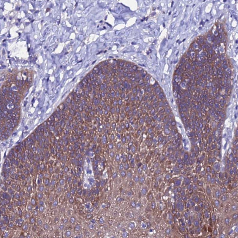 Anti-ARHGEF35 Antibody