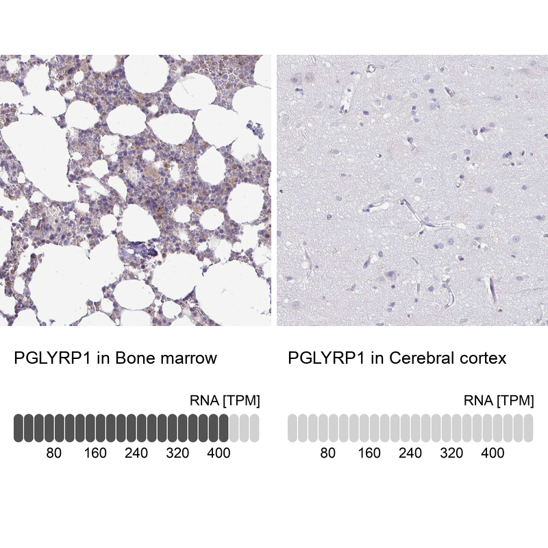 Anti-PGLYRP1 Antibody