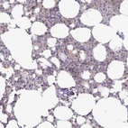 Immunohistochemical staining of human bone marrow shows high expression.