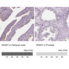 Anti-RIIAD1 Antibody