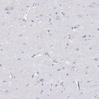 Immunohistochemical staining of human cerebral cortex shows low expression as expected.