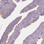 Immunohistochemical staining of human fallopian tube shows high expression.