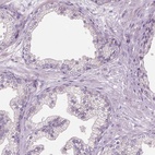 Anti-RIIAD1 Antibody