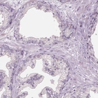 Immunohistochemical staining of human prostate shows low expression as expected.
