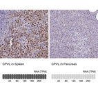 Anti-CPVL Antibody