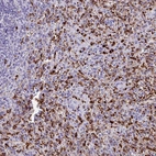 Immunohistochemical staining of human spleen shows high expression.