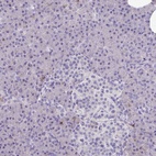 Anti-CPVL Antibody