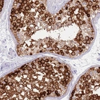 Anti-EVPLL Antibody