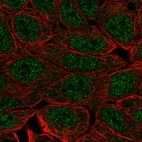 Immunofluorescent staining of human cell line RT4 shows localization to nucleoplasm.