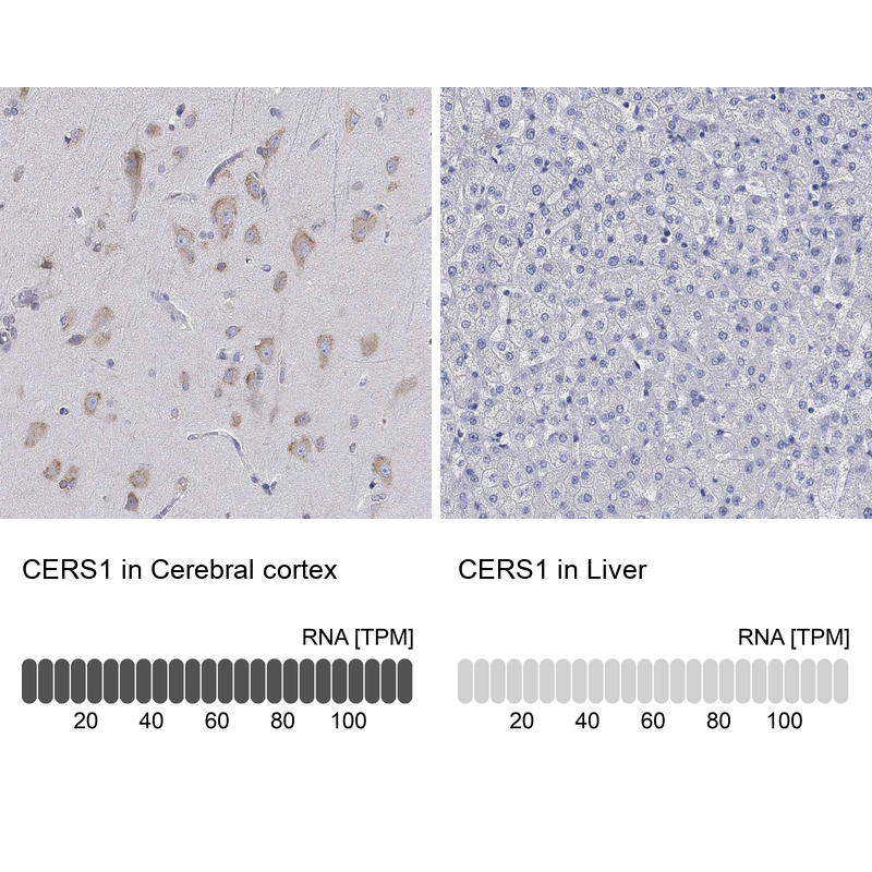 Anti-CERS1 Antibody
