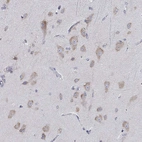 Immunohistochemical staining of human cerebral cortex shows moderate cytoplasmic positivity in neuronal cells.