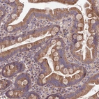 Immunohistochemical staining of human small intestine shows moderate granular cytoplasmic positivity in glandular cells.