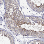 Immunohistochemical staining of human testis shows moderate cytoplasmic positivity in cells in seminiferous ducts.