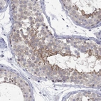 Immunohistochemical staining of human testis shows moderate cytoplasmic positivity in cells in seminiferous ducts.