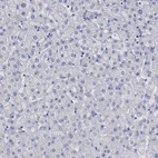 Immunohistochemical staining of human liver shows no positivity in hepatocytes as expected.