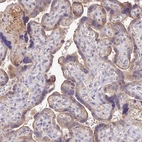 Immunohistochemical staining of human placenta shows weak granular cytoplasmic positivity in trophoblastic cells.