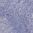 Immunohistochemical staining of human tonsil shows no positivity in non-germinal center cells as expected.