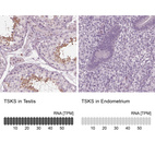 Anti-TSKS Antibody