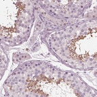 Immunohistochemical staining of human testis shows high expression.