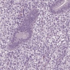 Immunohistochemical staining of human endometrium shows low expression as expected.