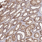 Immunohistochemical staining of human kidney shows moderate granular cytoplasmic positivity in cells in tubules.