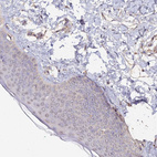 Immunohistochemical staining of human skin shows no positivity in squamous epithelial cells as expected.