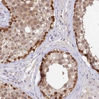 Anti-C10orf55 Antibody