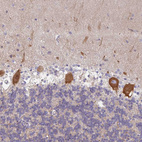 Anti-AMPD2 Antibody