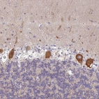 Anti-AMPD2 Antibody