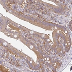 Immunohistochemical staining of human duodenum shows moderate cytoplasmic positivity in glandular cells.