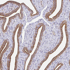 Immunohistochemical staining of human fallopian tube shows moderate cytoplasmic positivity in glandular cells.
