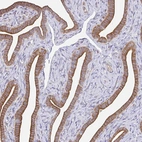 Immunohistochemical staining of human fallopian tube shows moderate cytoplasmic positivity in glandular cells.
