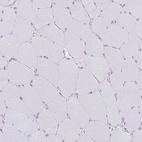 Immunohistochemical staining of human skeletal muscle shows negative cytoplasmic positivity in myocytes as expected.