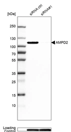 Western blot analysis in U2OS cells transfected with control siRNA, target specific siRNA probe #1, using Anti-AMPD2 antibody. Remaining relative intensity is presented. Loading control: Anti-GAPDH.