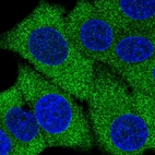Immunofluorescent staining of human cell line MCF7 shows localization to cytosol.
