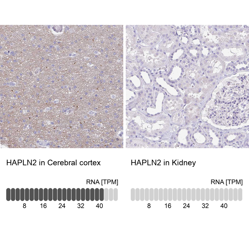 Anti-HAPLN2 Antibody