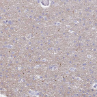 Immunohistochemical staining of human cerebral cortex shows weak positivity in neuropil.