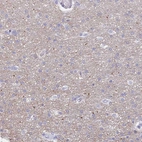 Immunohistochemical staining of human cerebral cortex shows weak positivity in neuropil.