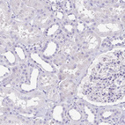 Immunohistochemical staining of human kidney shows no positivity in cells in tubules as expected.