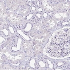 Immunohistochemical staining of human kidney shows no positivity in cells in tubules as expected.