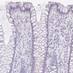 Immunohistochemical staining of human rectum shows no positivity in glandular cells as expected.
