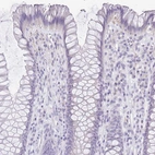 Immunohistochemical staining of human rectum shows no positivity in glandular cells as expected.