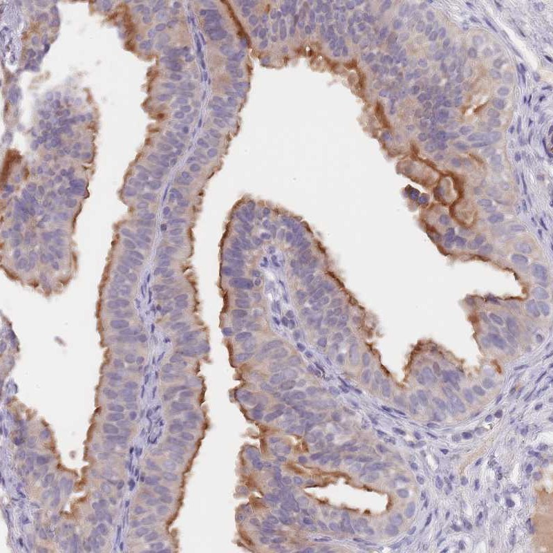 Anti-C1orf189 Antibody