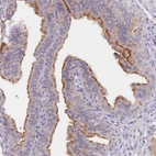 Anti-C1orf189 Antibody