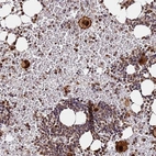 Anti-RGS18 Antibody