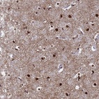 Anti-RAVER2 Antibody