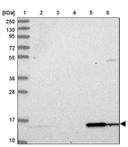 Anti-DUSP23 Antibody