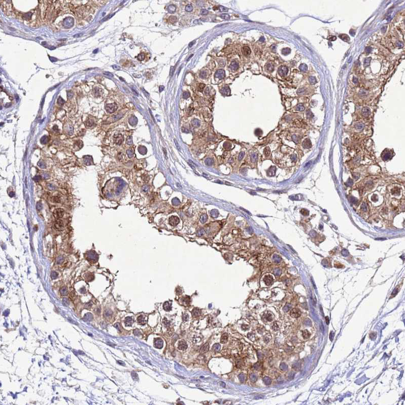 Anti-TBK1 Antibody