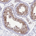 Anti-TBK1 Antibody