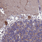 Immunohistochemical staining of human Cerebellum shows moderate nuclear and cytoplasmic positivity in Purkinje cells.